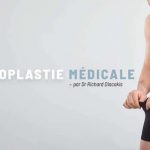 Docteur Diacakis: la pénoplastie naturelle et sans chirurgie Docteur Diacakis