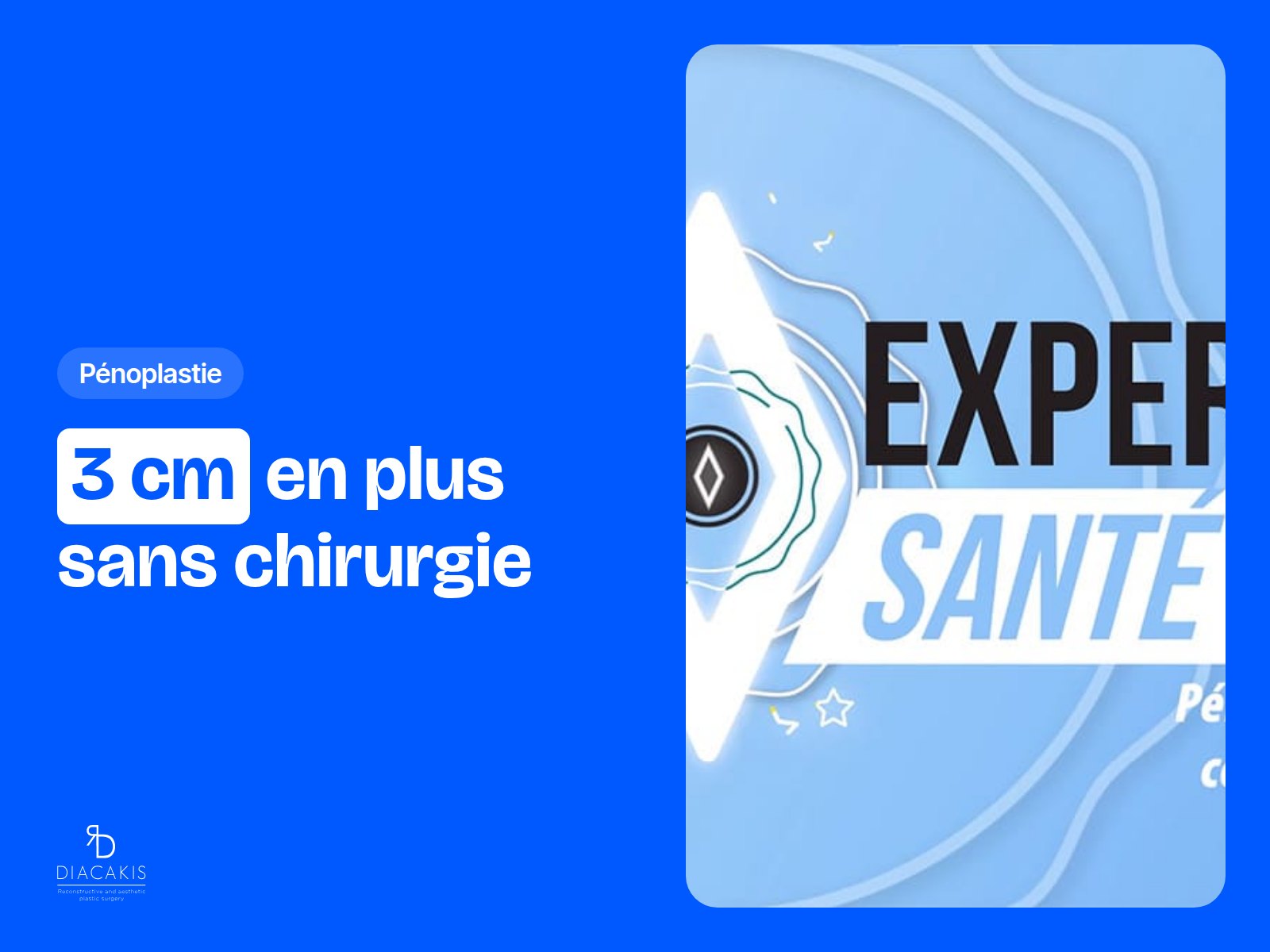 Pénoplastie médicale : 3 centimètres en plus sans passer par la chirurgie