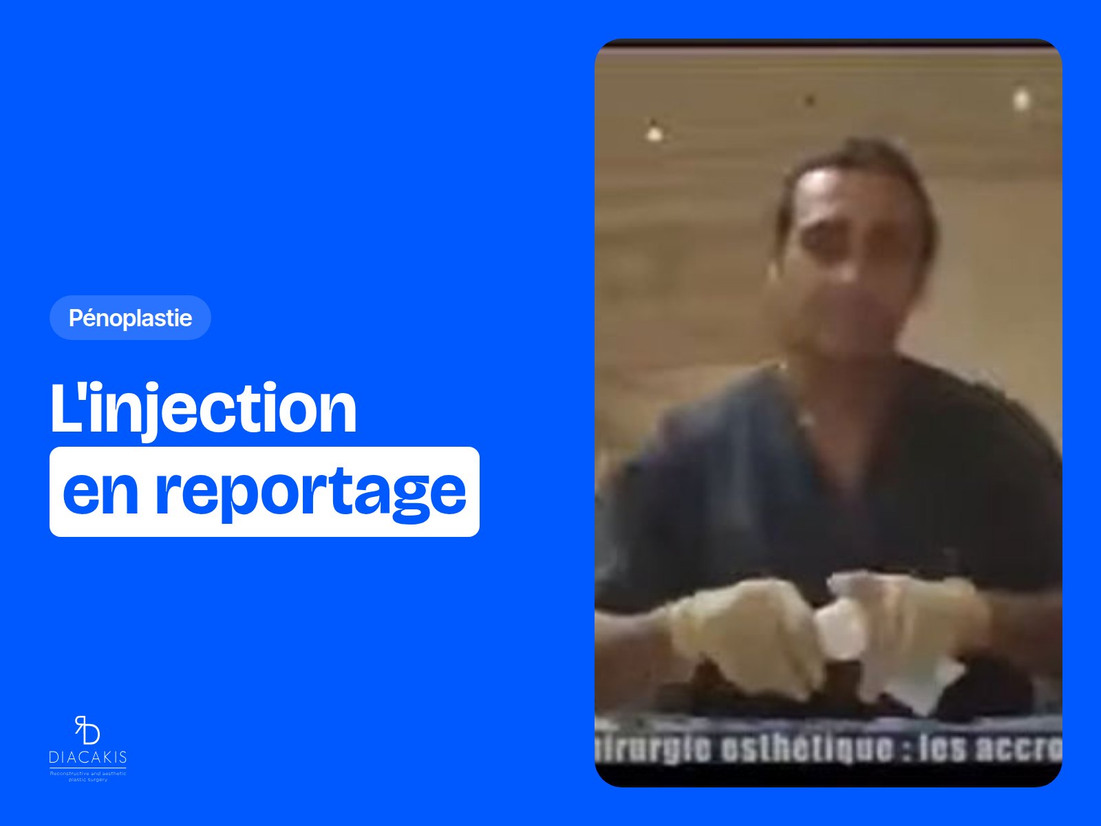 Injection d'acide hyaluronique dans le pénis - Reportage Docteur Diacakis